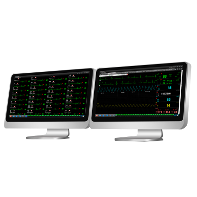 Software para Central de Monitoreo - EDAN